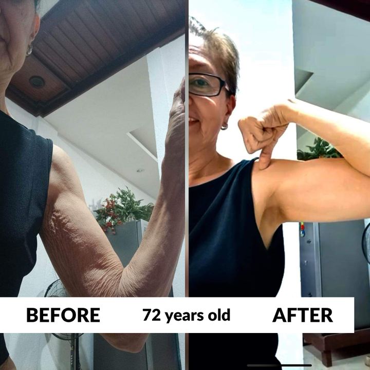 Student, 72 years old, before and after